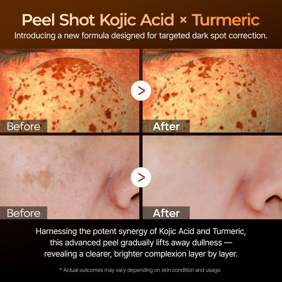 Dr Melaxin Peel shot Kojic Acid Turmeric Serum